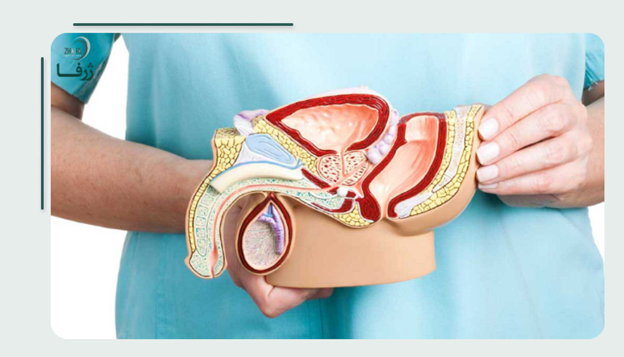 رایج‌ترین روش‌های بدون جراحی درمان پروستات